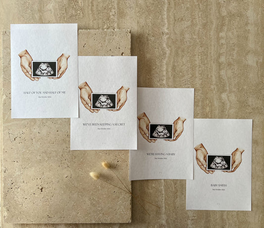 ULTRASOUND BABY ANNOUNCEMENT CUSTOMISED BY WILLOW AND SAGE CO
